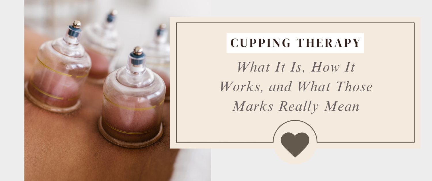 cupping therapy