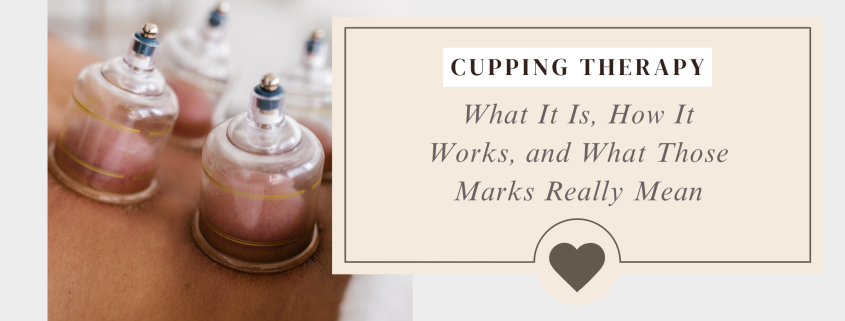 cupping therapy
